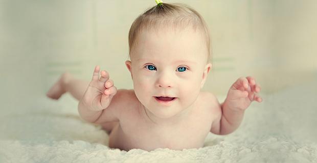 Um exame médico que pode fazer com que não nasçam mais bebês com síndrome de Down-0